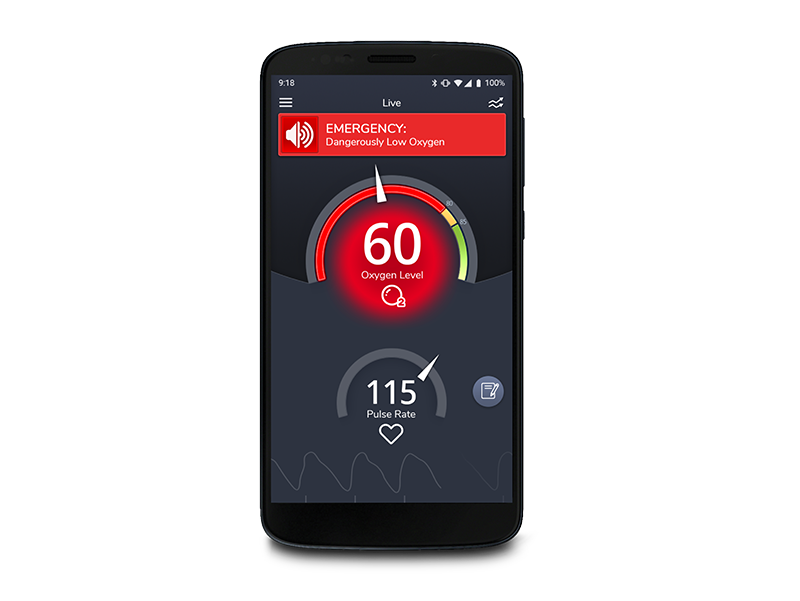 Phone displaying Masimo SafetyNet Alert App Emergency Screen